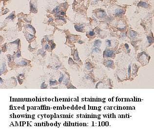 PRKAB1 / AMPK Beta 1 Antibody (N-Terminus)
