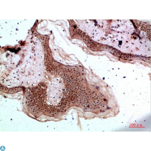 TPSD1 / Tryptase Delta 1 Antibody