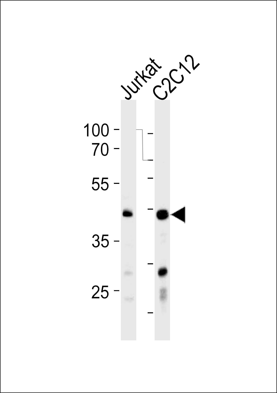 POLDIP3 / p46 Antibody (aa93-120)