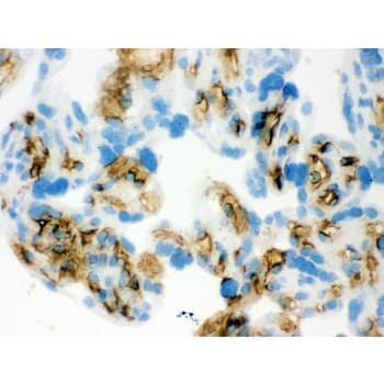 SLC4A1 / Band 3 / AE1 Antibody (aa28-365)