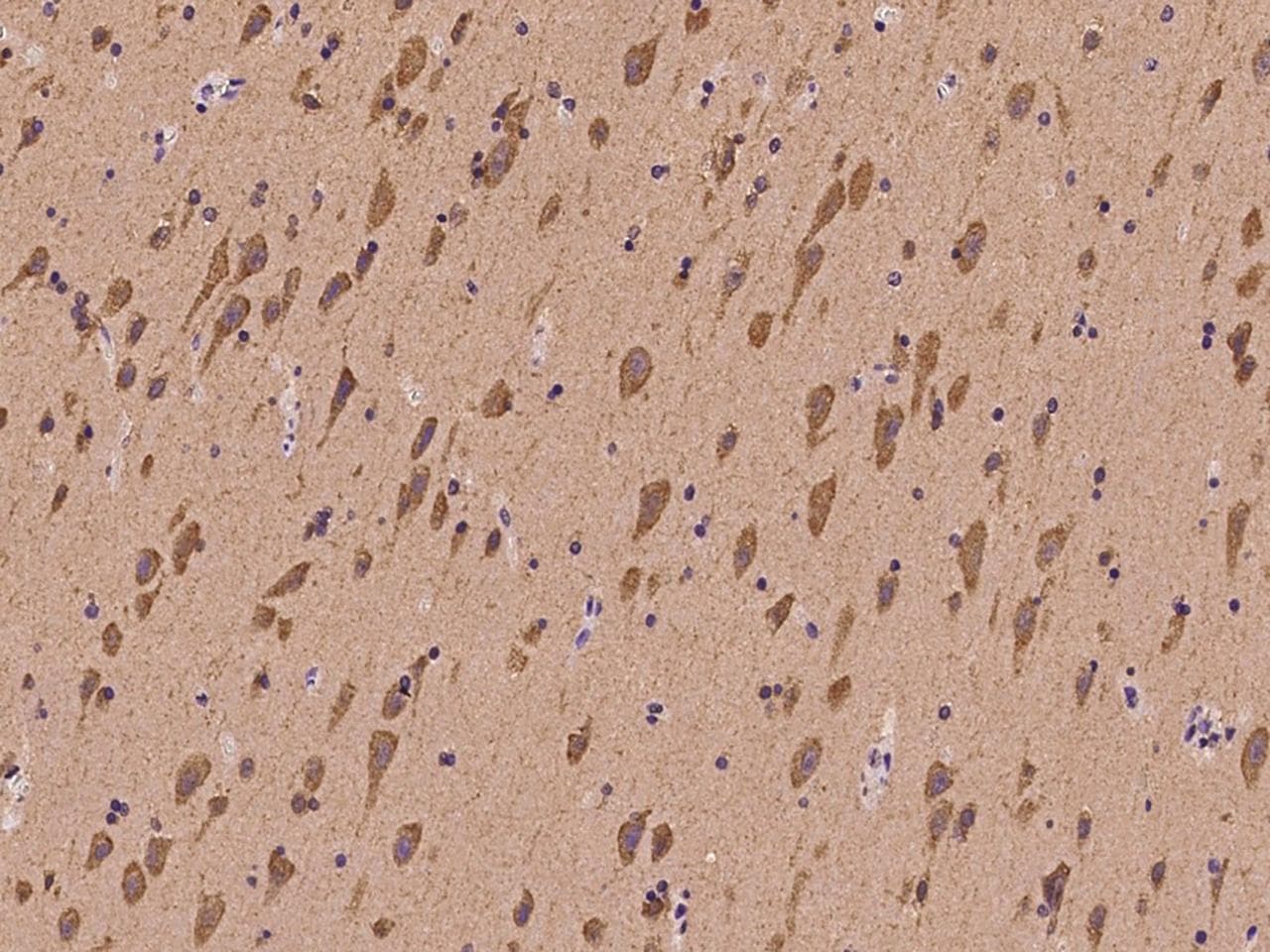 GRIK2 / GLUR6 Antibody