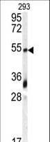 GDF10 / BMP3B Antibody (aa33-62)