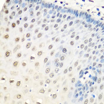 Polyclonal Rabbit anti-Human HnRNP A0 Antibody (IHC, WB)