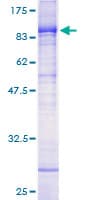 Human PIAS4 / PIASY Protein (Recombinant GST)