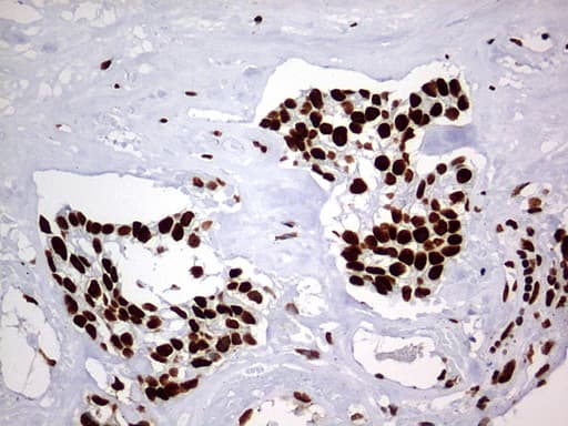 Monoclonal Mouse anti-Human HNRPM / HNRNPM Antibody (clone OTI1F6, aa1-261, IHC, WB)