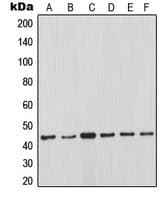 MCL1 / MCL 1 Antibody (Internal)