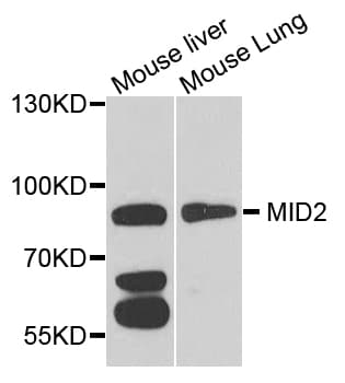 Polyclonal Rabbit anti-Human TRIM1 / MID2 Antibody (WB)