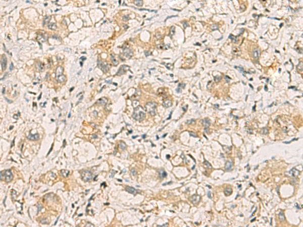 Polyclonal Rabbit anti-Human SQSTM1 Antibody (IHC, WB)