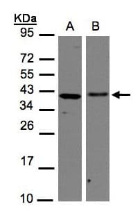 AIMP1 / EMAP II Antibody (aa1-263)