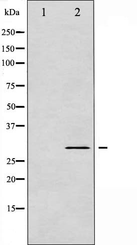 BCL2L1 / BCL-XL Antibody (phospho-Ser62)