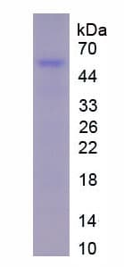 Rat FGB / Fibrinogen Beta Chain Protein (Recombinant His-S)