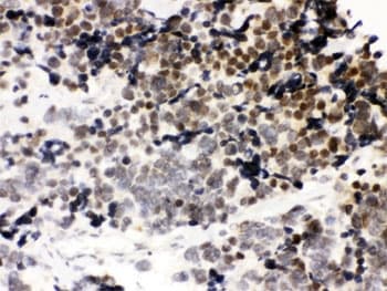 CTCF Antibody