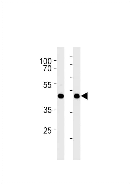 GPR68 / OGR1 Antibody (aa200-225)