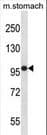 Polyclonal Rabbit anti-Mouse FER Antibody (aa783-810, WB)