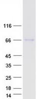 Human CFHR5 Protein (Recombinant Myc-DDK (Flag))
