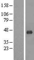 MCAT Protein (Over-Expression Lysate Myc-DDK (Flag))