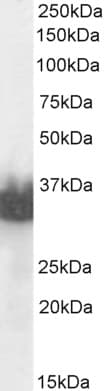 IHC-plus™ KLK3 / PSA Antibody (C Terminus)