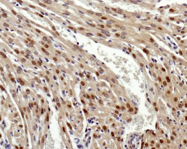 GLI2 Antibody (aa300-400)