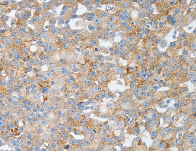 BPIFB2 Antibody
