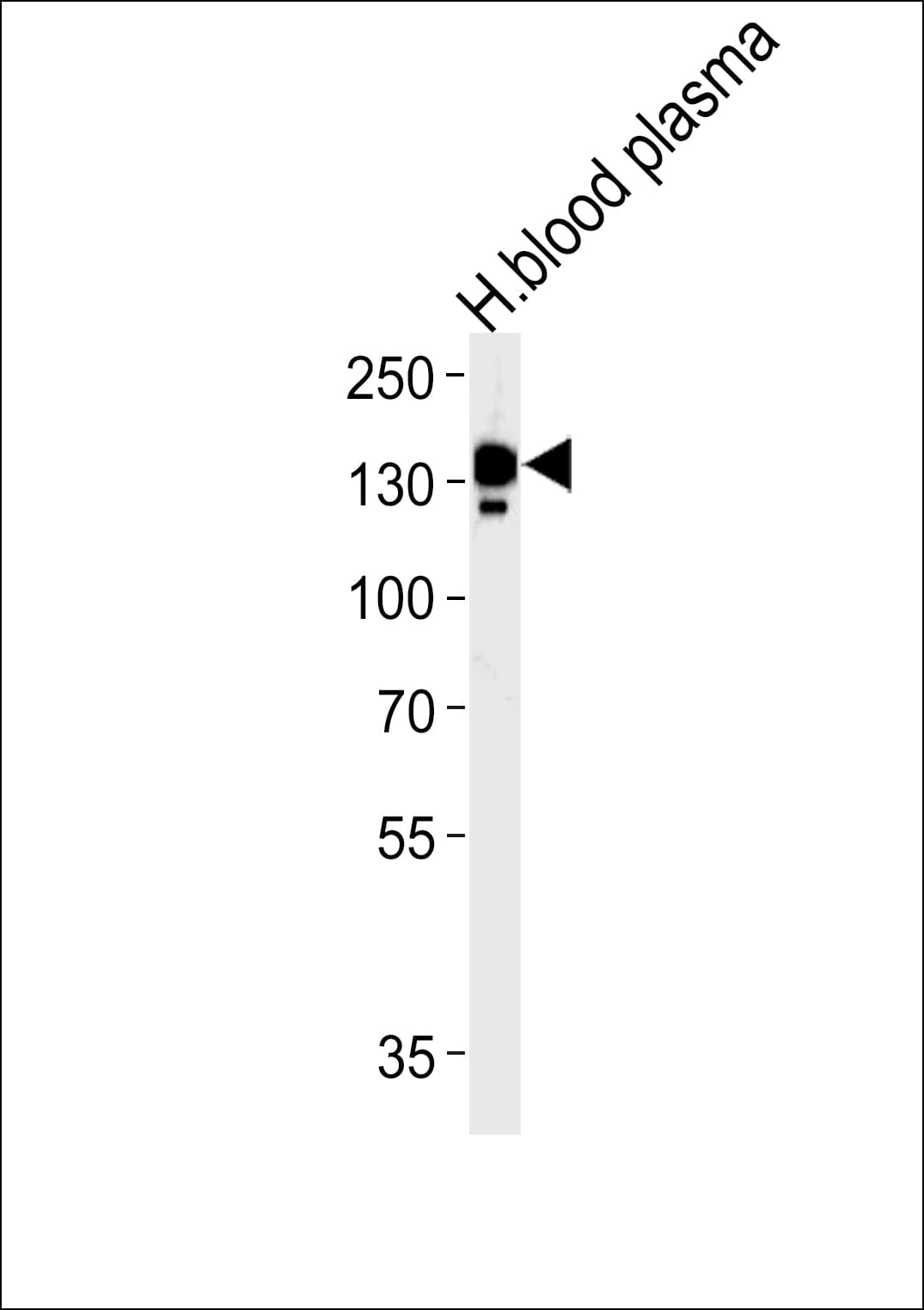 CP / Ceruloplasmin Antibody (aa121-151)