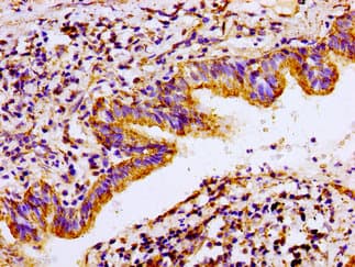 ACO2 / Aconitase 2 Antibody