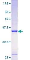 Human TIMP1 Protein (Recombinant GST)