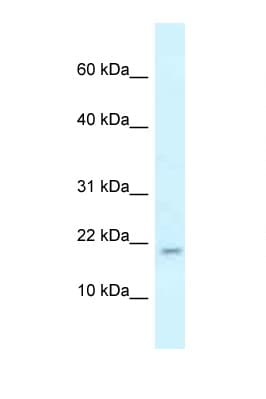 RBM3 Antibody (N-Terminus)