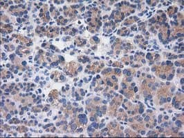 SULT1C2 / Sulfotransferase 1C2 Antibody (clone OTI4G1)