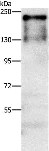 ATAD5 / ELG1 Antibody