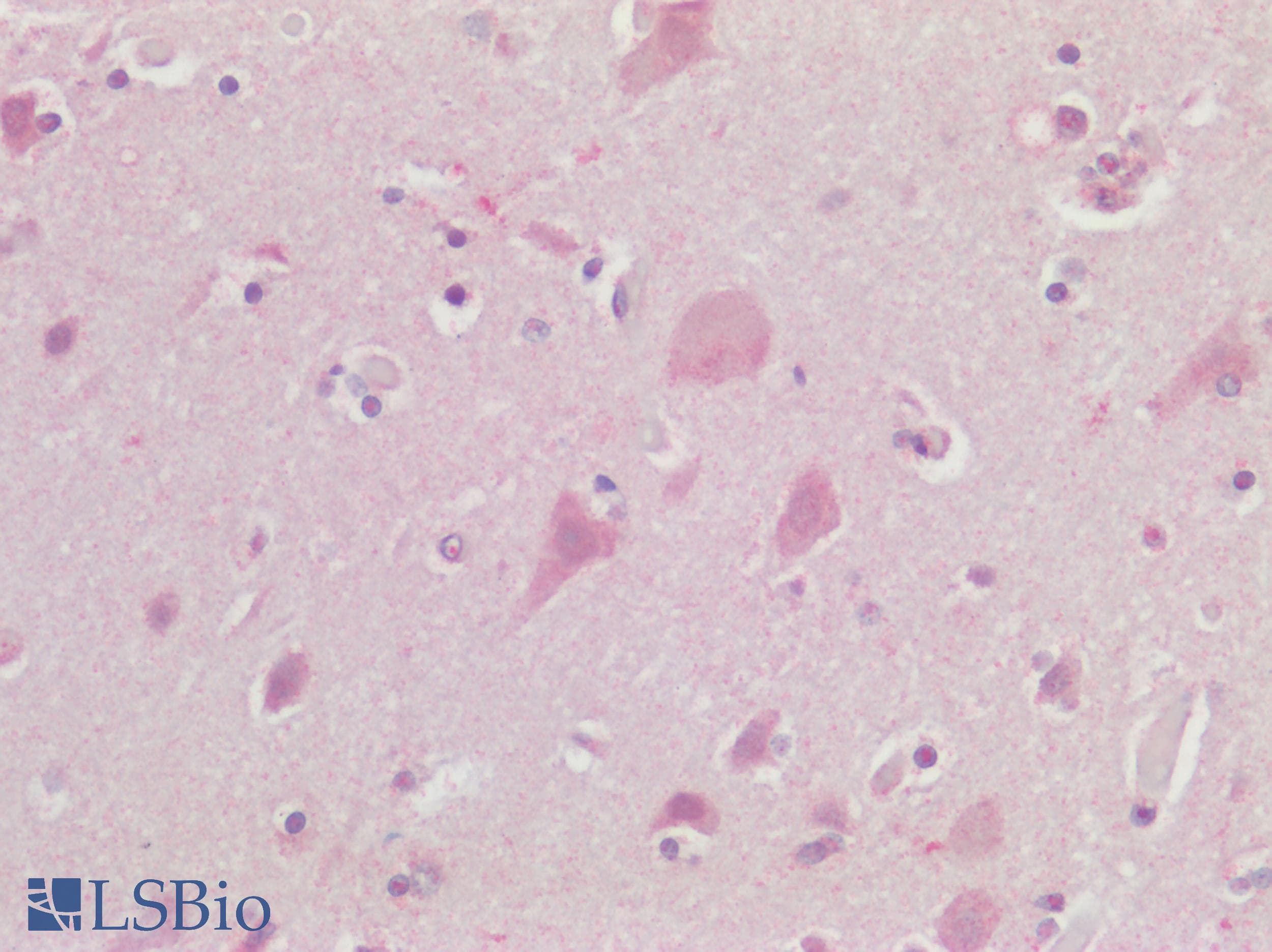 PathPlus™ CHRM3 / M3 Antibody (C-Terminus)