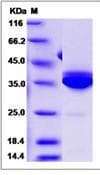 Human Statherin / STR Protein (Recombinant His,C-terminus)