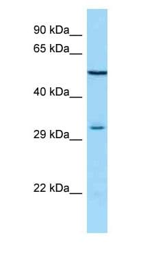 MAGE12 / MAGEA12 Antibody (aa69-118)