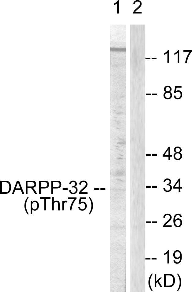 Polyclonal Rabbit anti-Human PPP1R1B / DARPP-32 Antibody (phospho-Thr75, IHC, WB)