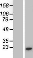 PMS2L3 Protein (Over-Expression Lysate Myc-DDK (Flag))