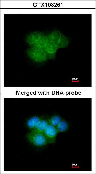 CALB2 / Calretinin Antibody