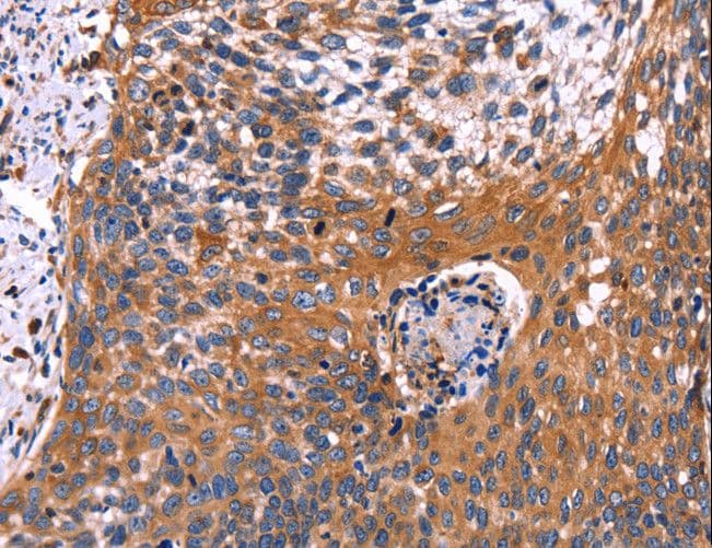 RDX / Radixin Antibody