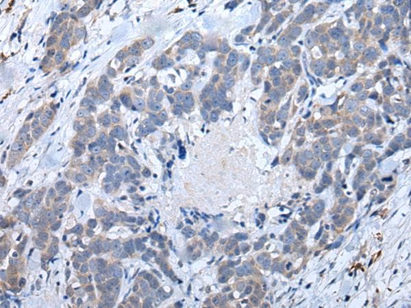 ATM Antibody
