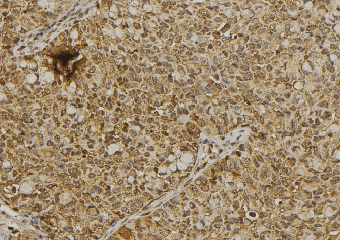 CCN4 / WISP1 Antibody