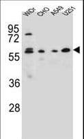 Polyclonal Rabbit anti-Human CEP70 Antibody (aa309-338, IHC, WB)