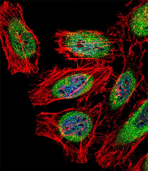 Polyclonal Rabbit anti-Human SP140 Antibody (aa272-301, IHC, IF, WB)