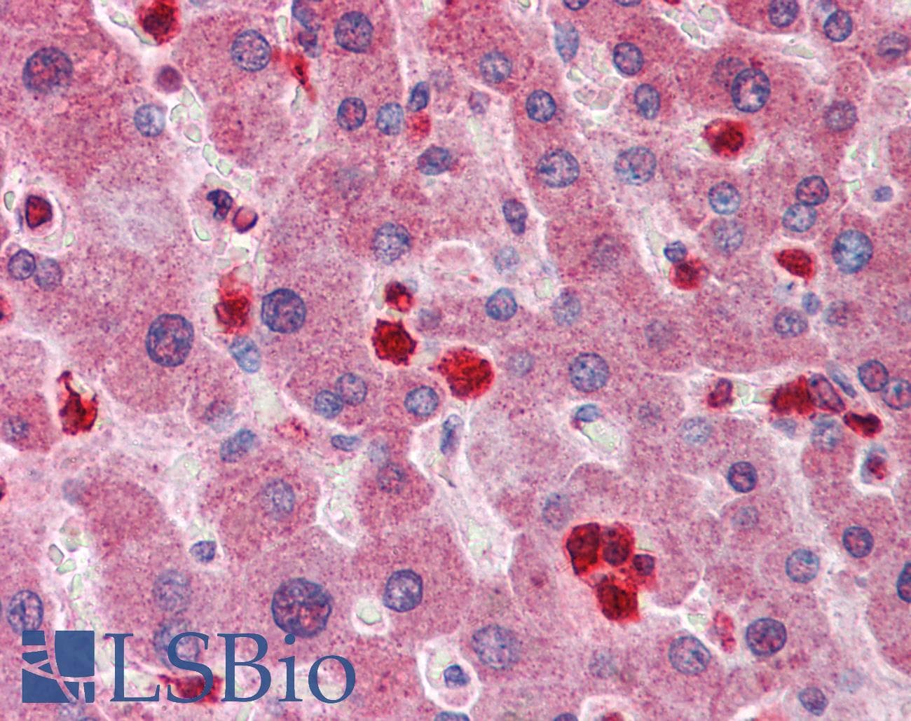 Polyclonal Rabbit anti-Human GCLM Antibody (aa182-231, IHC, WB)