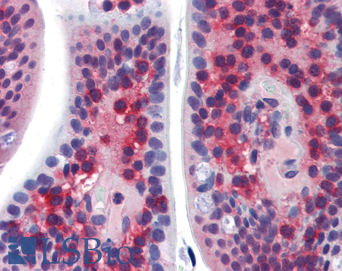 Polyclonal Rabbit anti-Human SSX2IP Antibody (aa362-411, IHC, WB)