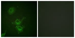 EGFR Antibody (phospho-Thr693)