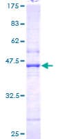 Human NAT5 / NAA20 Protein (Recombinant GST)