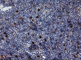 ERBB2 / HER2 Antibody (aa676-1255, clone OTI4F6, Carrier-free)
