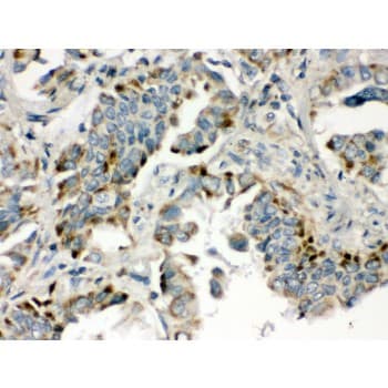 BMP5 Antibody (aa332-365)