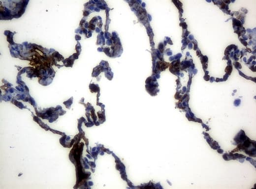 HP / Haptoglobin Antibody (clone UMAB10)