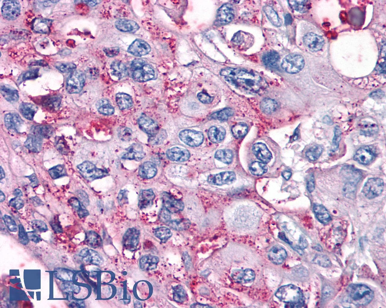 IHC-plus™ Polyclonal Rabbit anti-Human GPRC5A / RAI3 Antibody (Cytoplasmic Domain, IHC)
