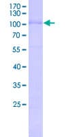 Human ESRRB / ERR Beta Protein (Recombinant GST, N-terminus)