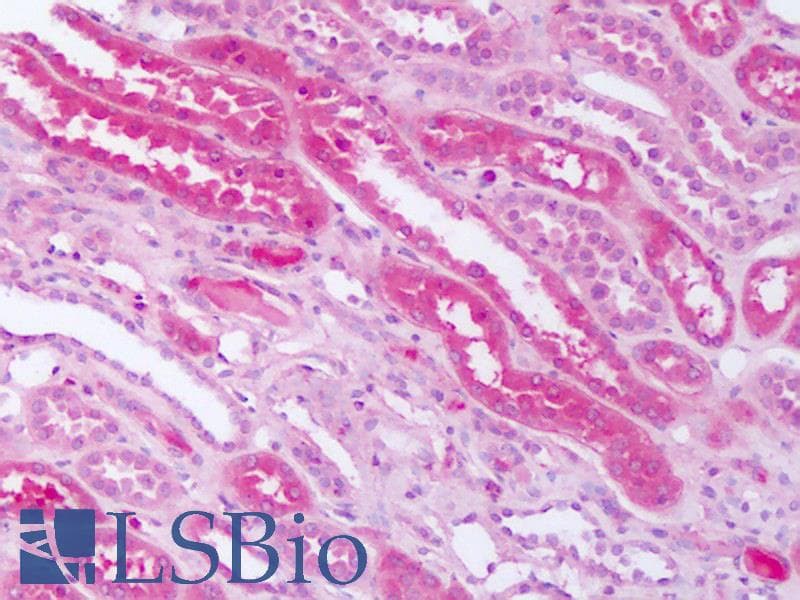 IHC-plus™ SMO / Smoothened Antibody (N-Terminus)